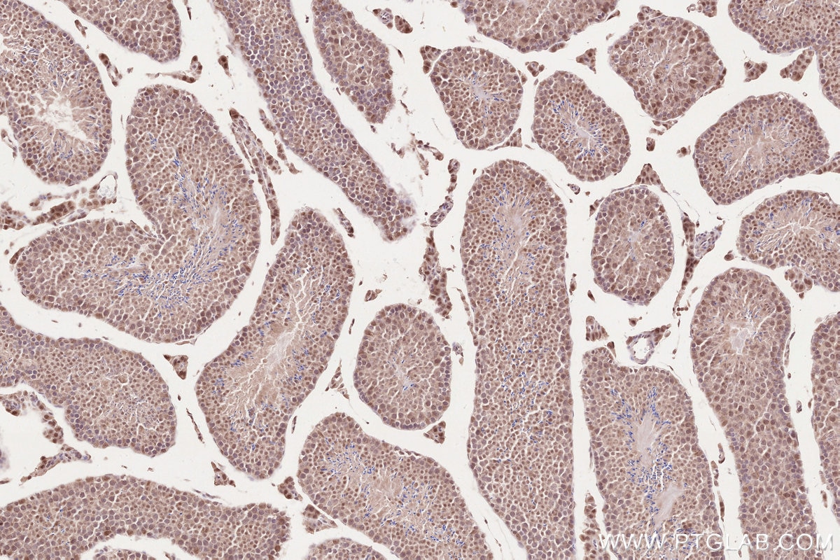 Immunohistochemistry (IHC) staining of mouse testis tissue using WAPL Polyclonal antibody (16370-1-AP)