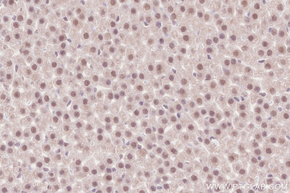 Immunohistochemistry (IHC) staining of rat adrenal gland tissue using WAPL Polyclonal antibody (16370-1-AP)
