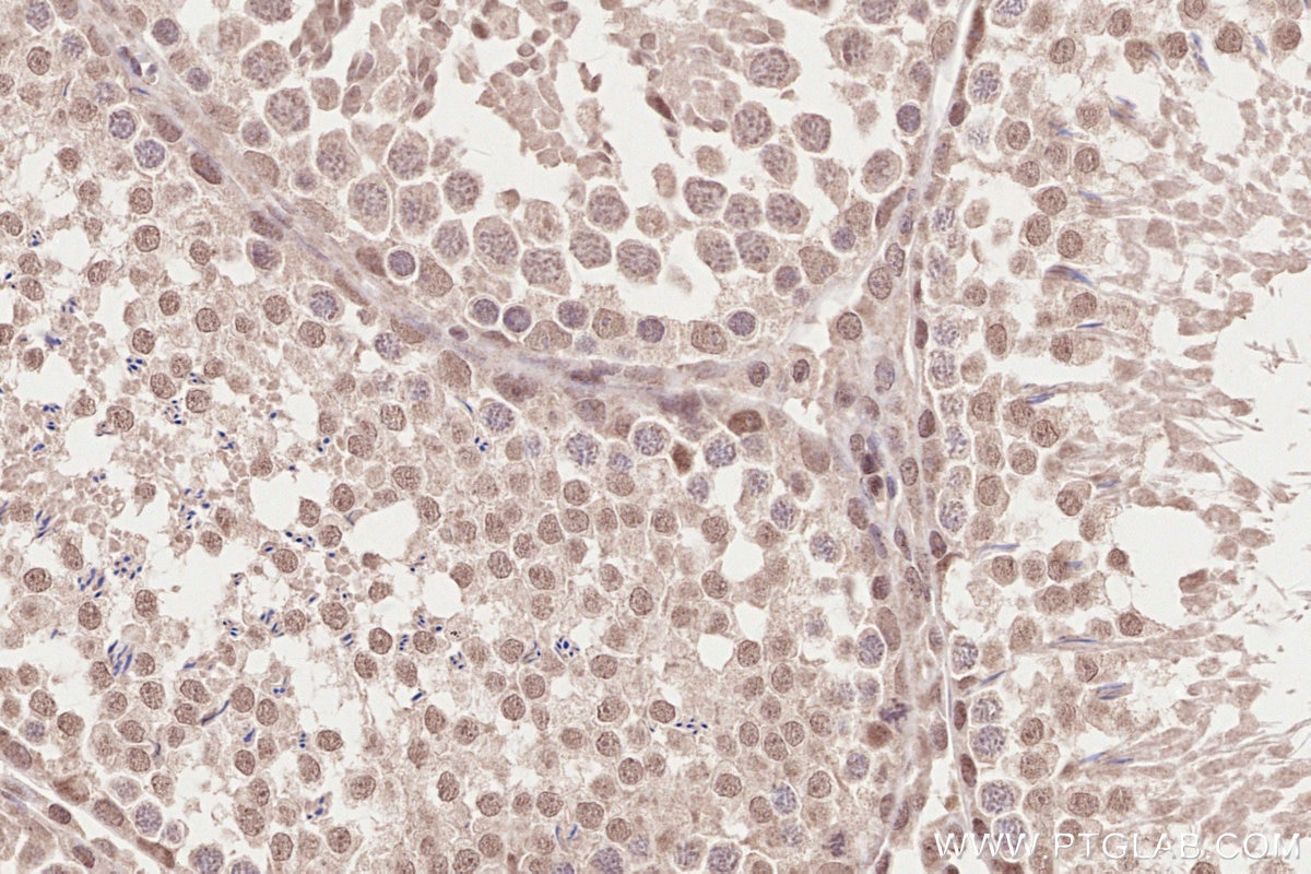Immunohistochemistry (IHC) staining of rat testis tissue using WAPL Polyclonal antibody (16370-1-AP)