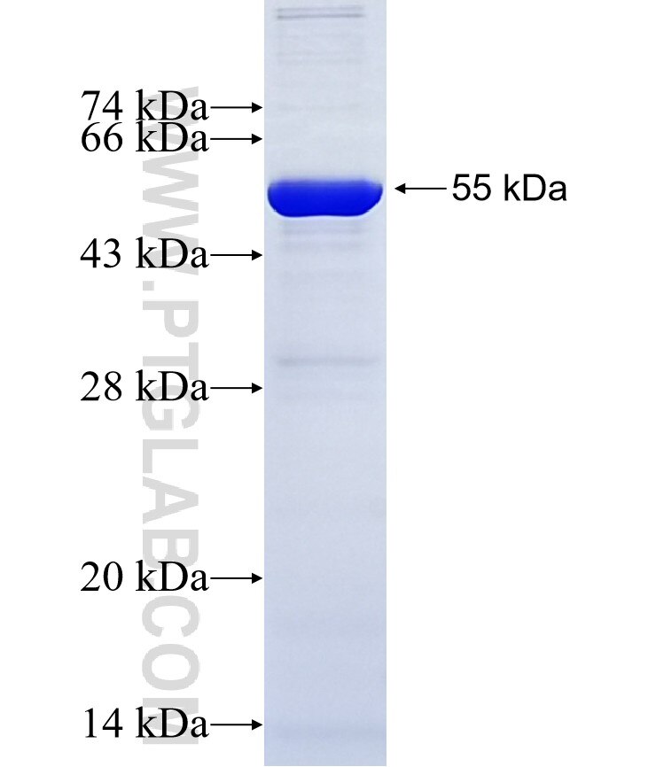 WAPL; WAPAL fusion protein Ag9585 SDS-PAGE