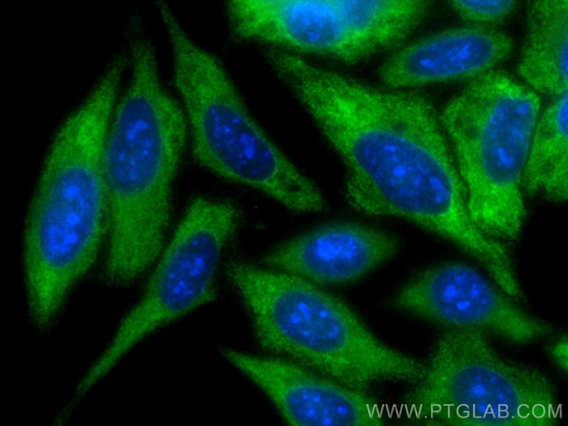 Immunofluorescence (IF) / fluorescent staining of HepG2 cells using TrpRS Polyclonal antibody (16081-1-AP)