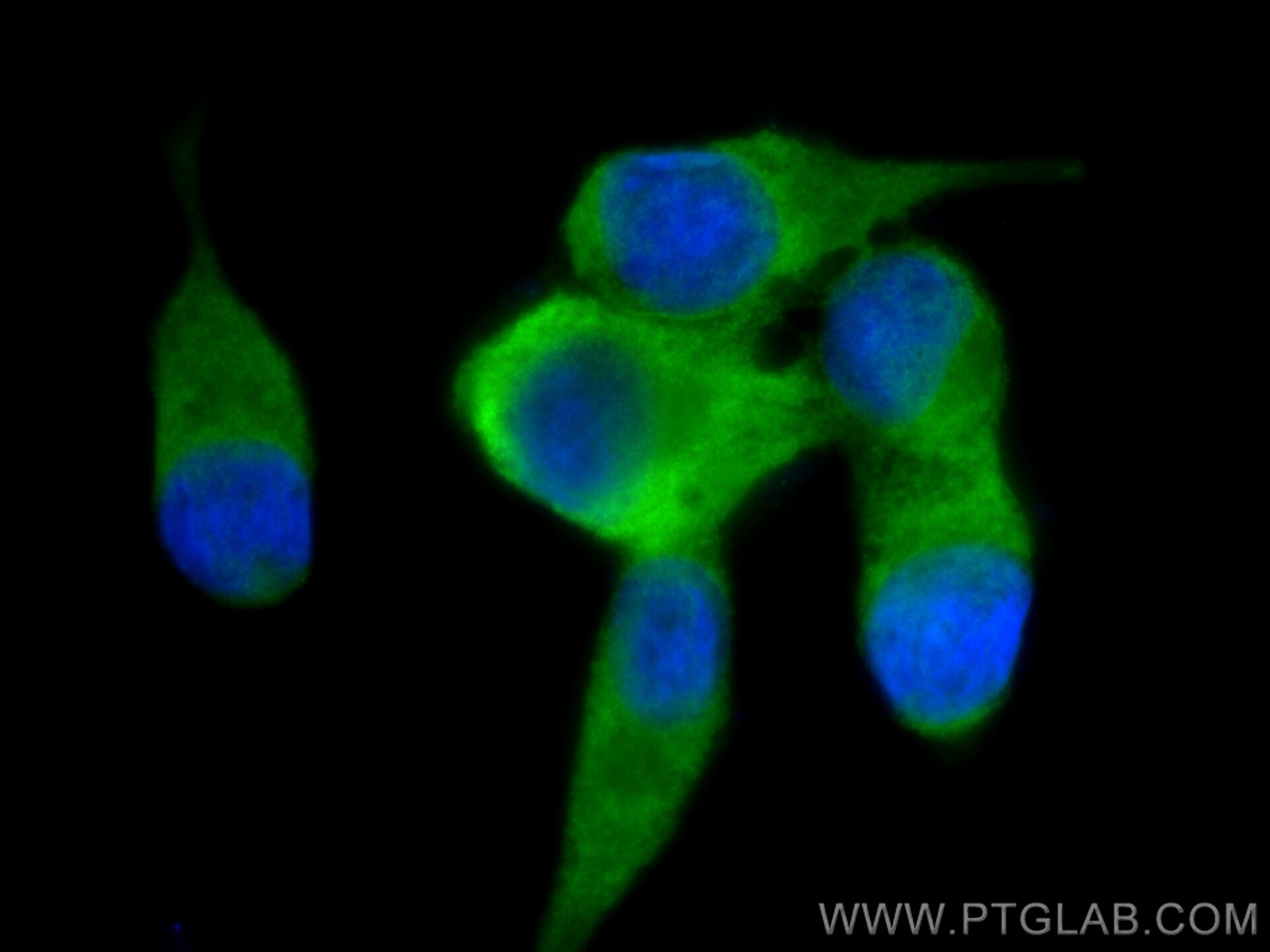 Immunofluorescence (IF) / fluorescent staining of LNCaP cells using TrpRS Monoclonal antibody (67952-1-Ig)