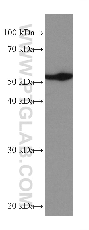 Western Blot (WB) analysis of 4T1 cells using TrpRS Monoclonal antibody (67952-1-Ig)