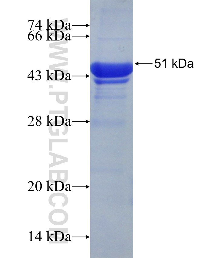 WARS fusion protein Ag31430 SDS-PAGE