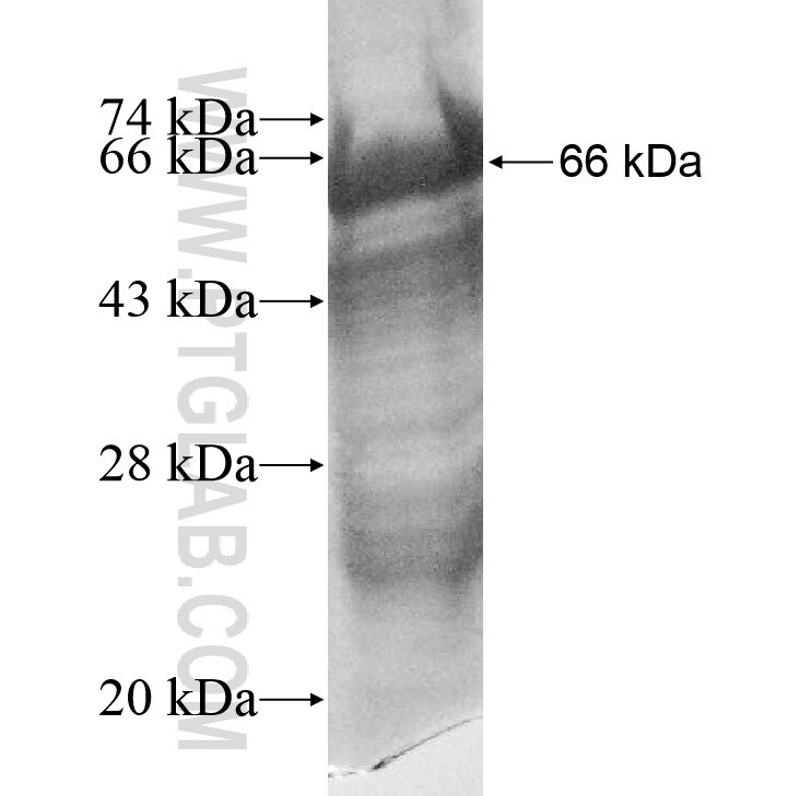 WARS fusion protein Ag9079 SDS-PAGE