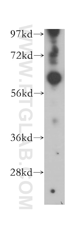 WB analysis of mouse brain using 13944-1-AP