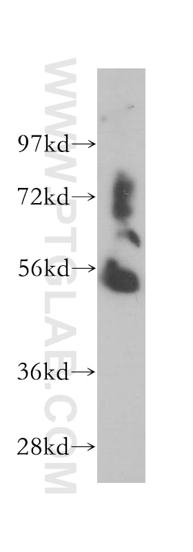 Western Blot (WB) analysis of human liver tissue using WARS2 Polyclonal antibody (13944-1-AP)