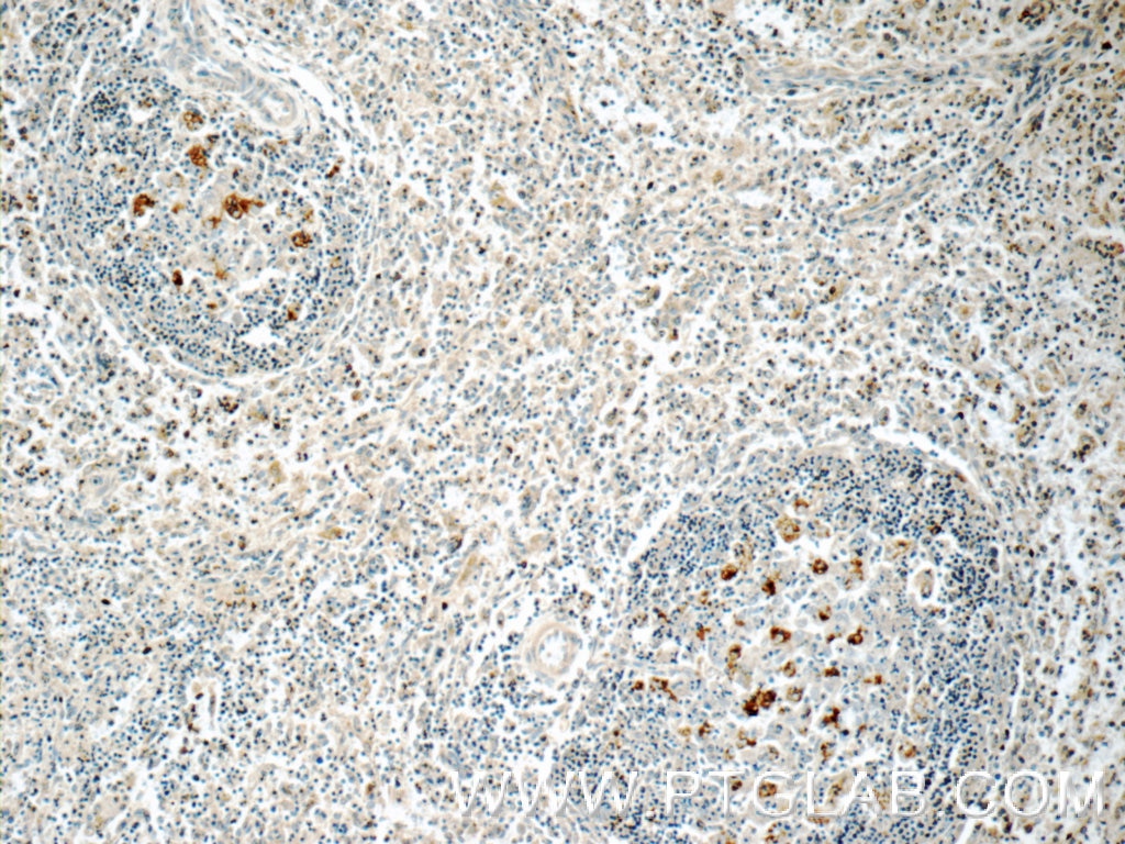 Immunohistochemistry (IHC) staining of human spleen tissue using WASP Polyclonal antibody (10987-1-AP)