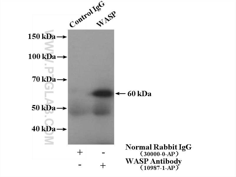 Immunoprecipitation (IP) experiment of rat spleen tissue using WASP Polyclonal antibody (10987-1-AP)