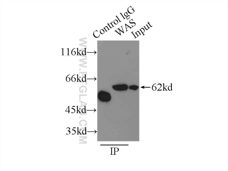 Immunoprecipitation (IP) experiment of Raji cells using WASP Polyclonal antibody (10987-1-AP)