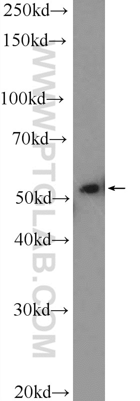 Western Blot (WB) analysis of HL-60 cells using WASP Polyclonal antibody (10987-1-AP)