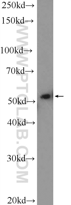 WB analysis of HL-60 using 10987-1-AP