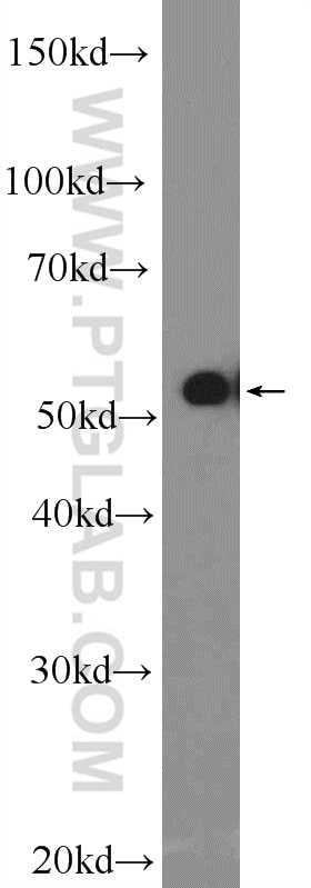 Western Blot (WB) analysis of Raji cells using WASP Polyclonal antibody (10987-1-AP)