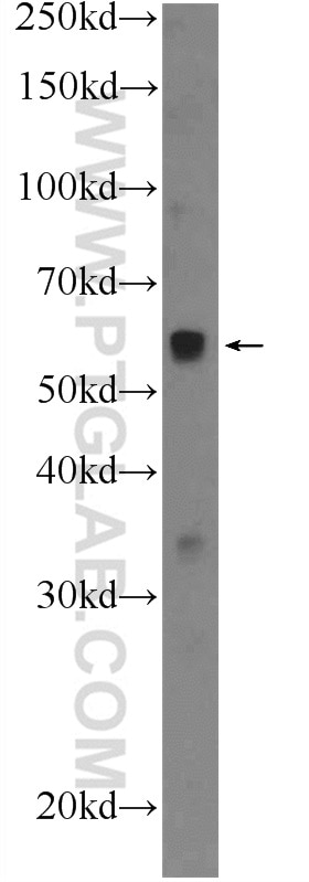 Western Blot (WB) analysis of mouse spleen tissue using WASP Polyclonal antibody (10987-1-AP)