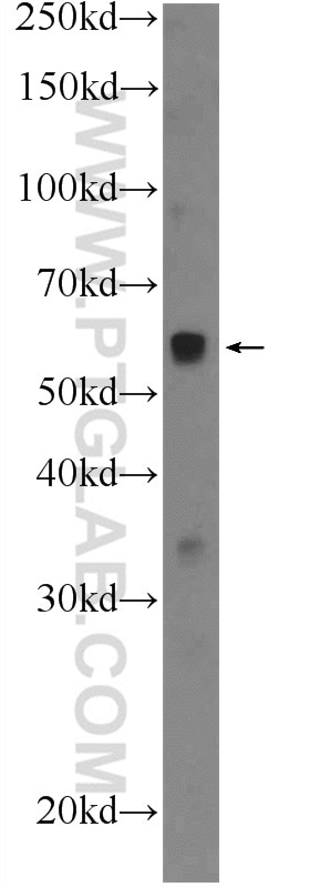 WB analysis of mouse spleen using 10987-1-AP