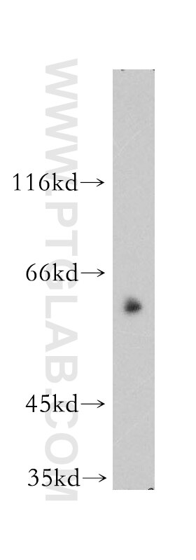 Western Blot (WB) analysis of K-562 cells using WASP Polyclonal antibody (10987-1-AP)