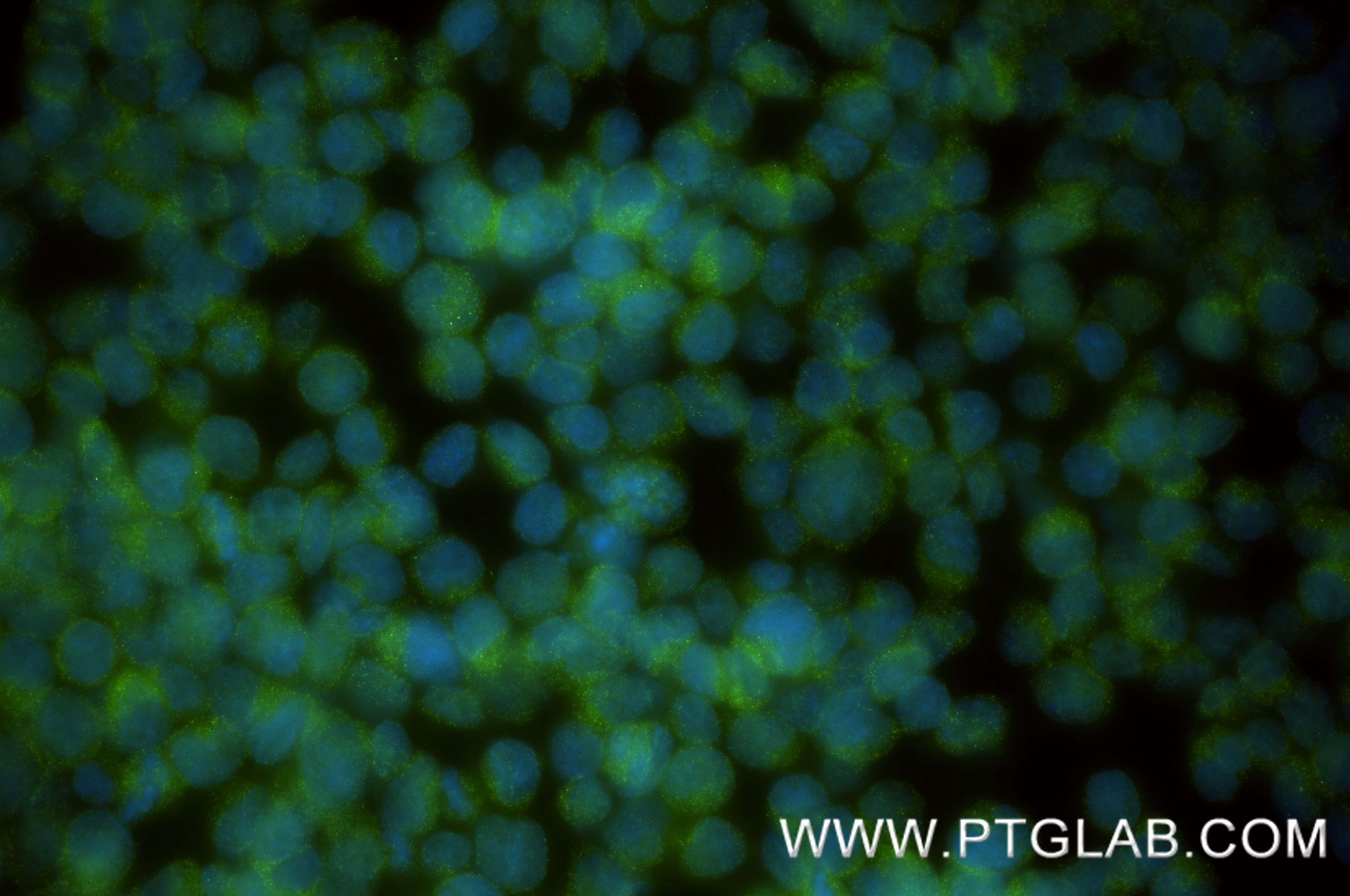 Immunofluorescence (IF) / fluorescent staining of Jurkat cells using WASP Recombinant monoclonal antibody (84714-2-RR)