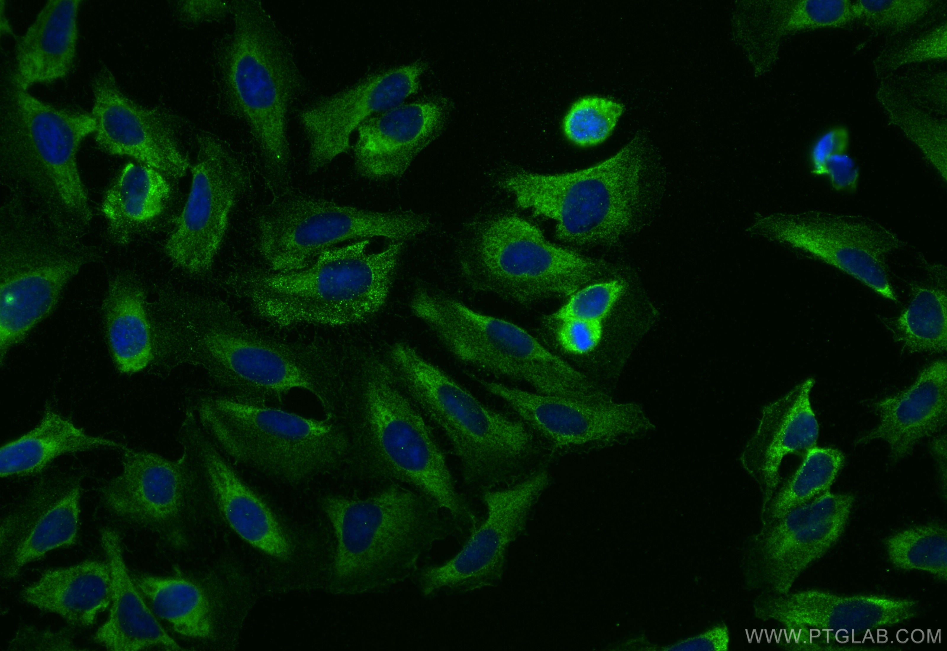 Immunofluorescence (IF) / fluorescent staining of U2OS cells using WASF2 Polyclonal antibody (31442-1-AP)