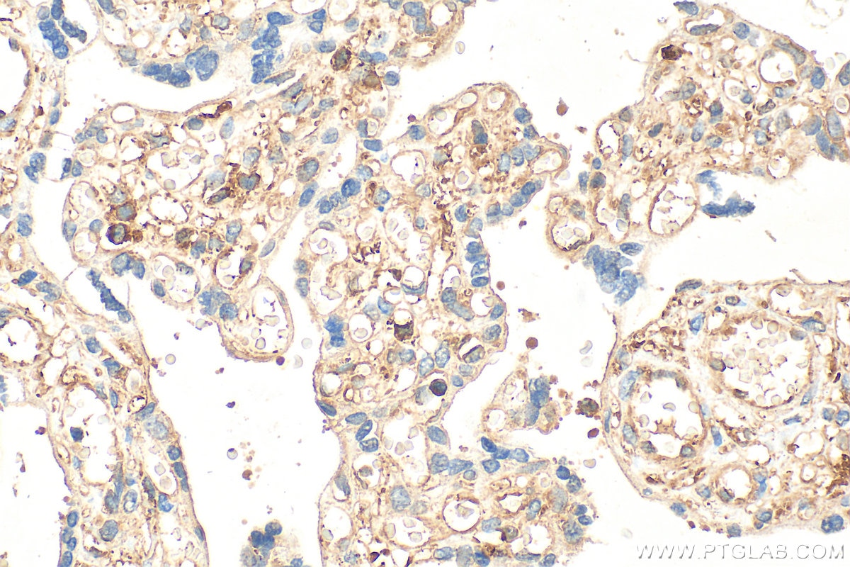 Immunohistochemistry (IHC) staining of human placenta tissue using WASF2 Polyclonal antibody (31442-1-AP)