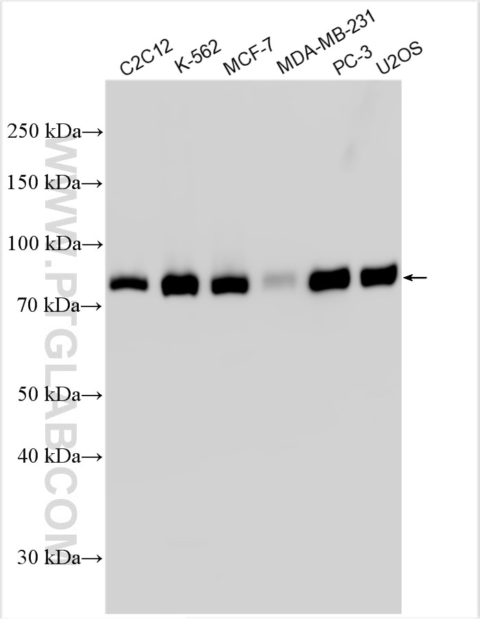 Western Blot (WB) analysis of various lysates using WASF2 Polyclonal antibody (31442-1-AP)