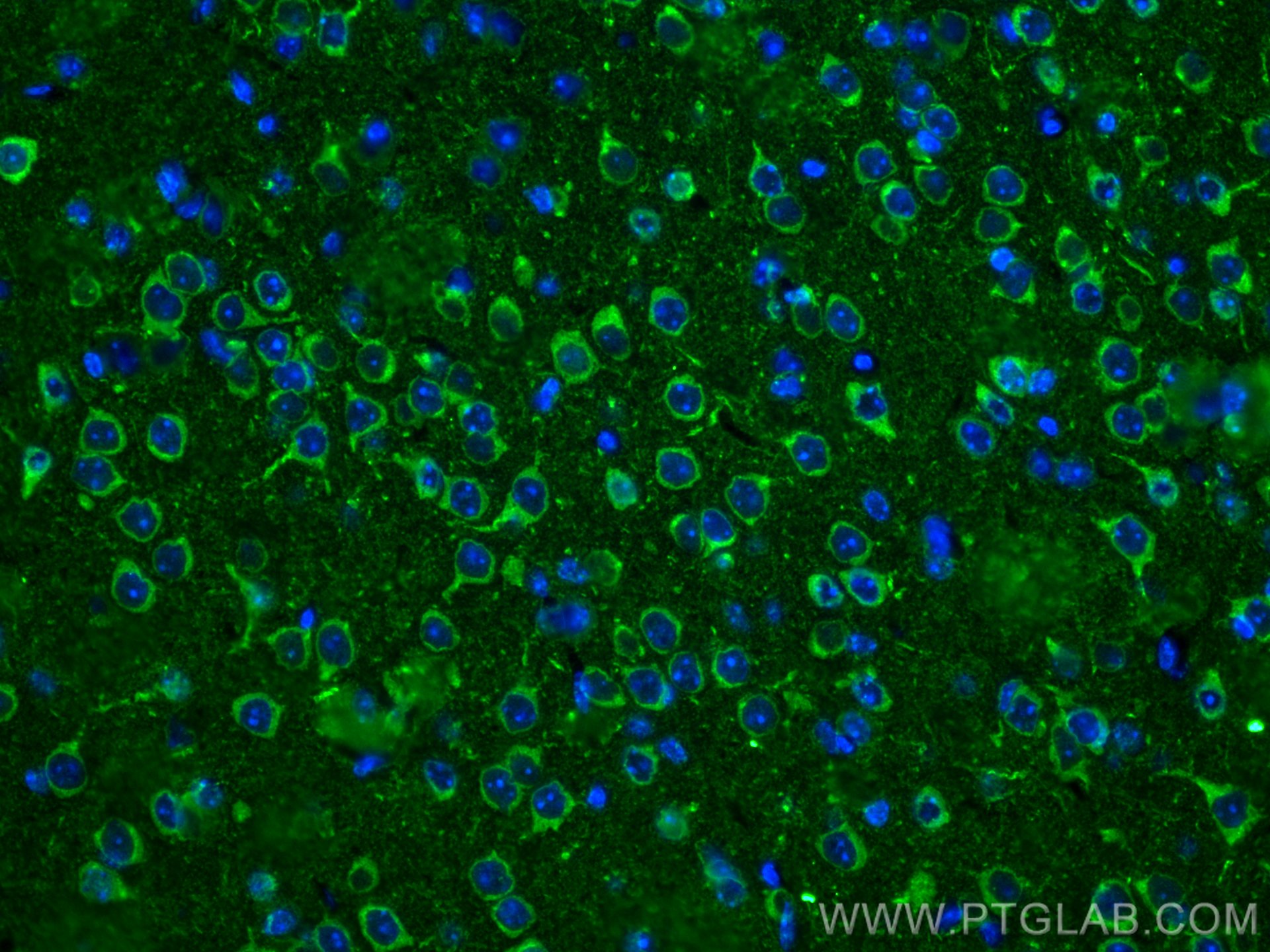 Immunofluorescence (IF) / fluorescent staining of mouse brain tissue using WASF3 Monoclonal antibody (67620-1-Ig)