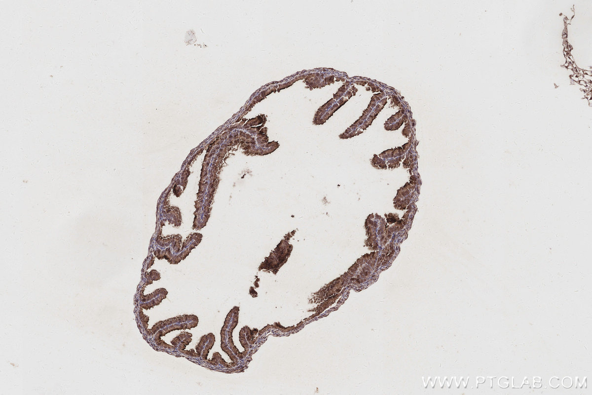 Immunohistochemistry (IHC) staining of mouse ovary tissue using WASF3 Monoclonal antibody (67620-1-Ig)