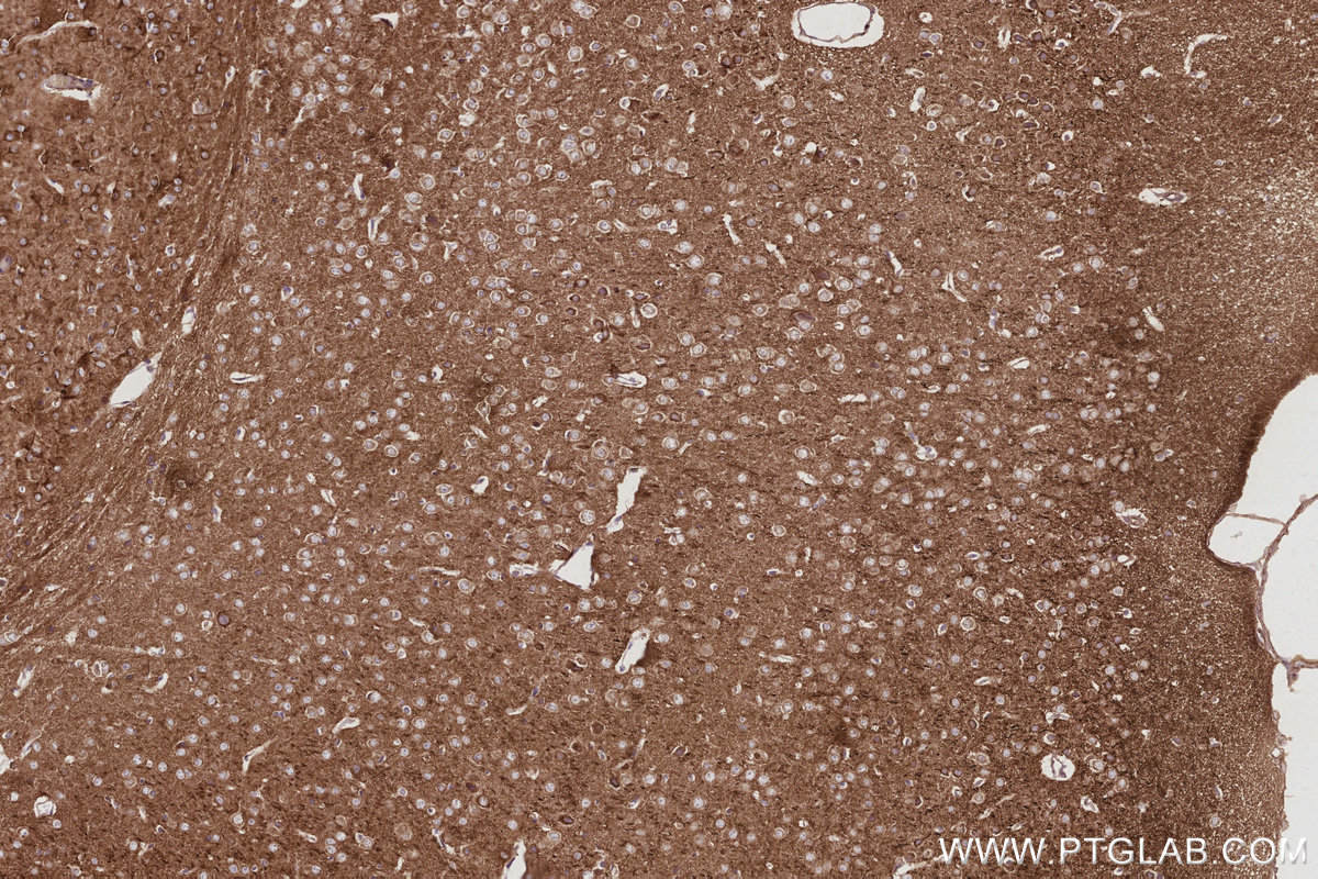 Immunohistochemistry (IHC) staining of mouse brain tissue using WASF3 Monoclonal antibody (67620-1-Ig)