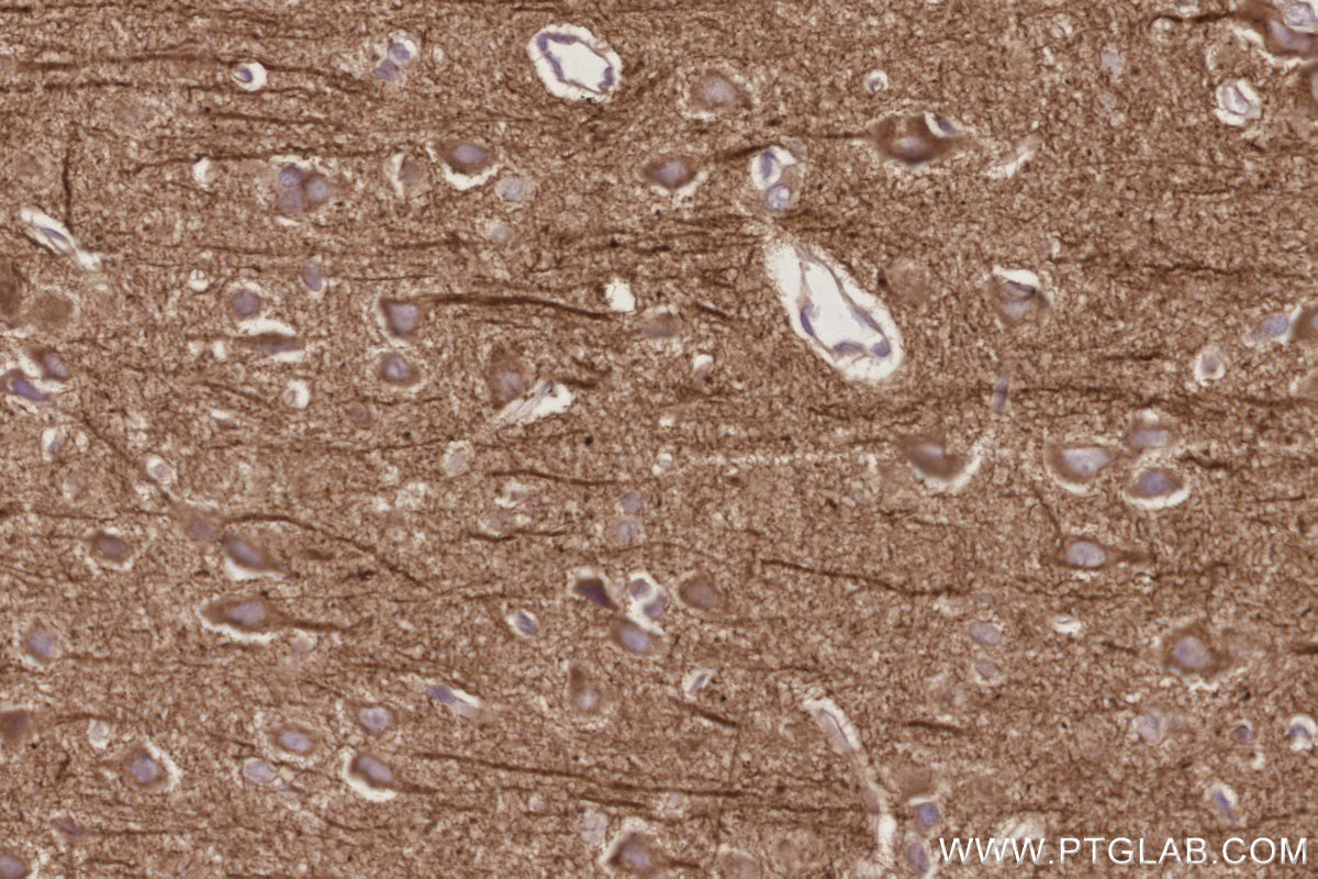 Immunohistochemistry (IHC) staining of rat brain tissue using WASF3 Monoclonal antibody (67620-1-Ig)