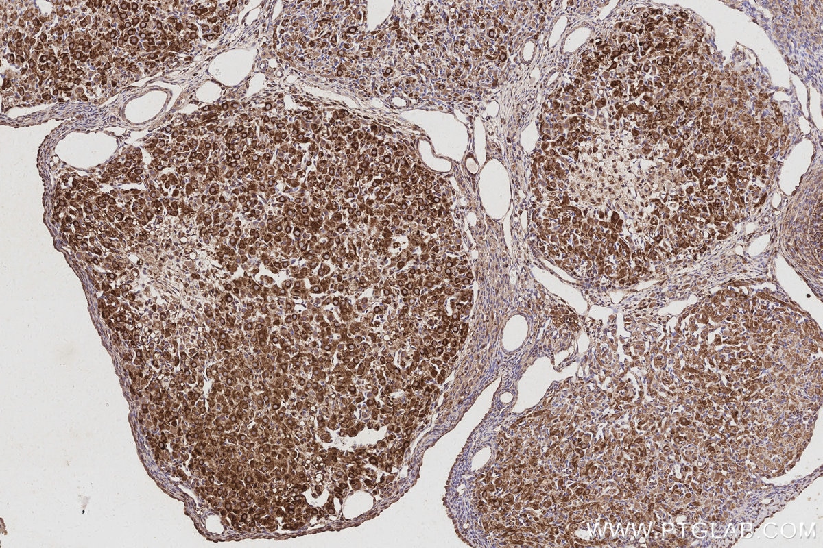 Immunohistochemistry (IHC) staining of rat ovary tissue using WASF3 Monoclonal antibody (67620-1-Ig)