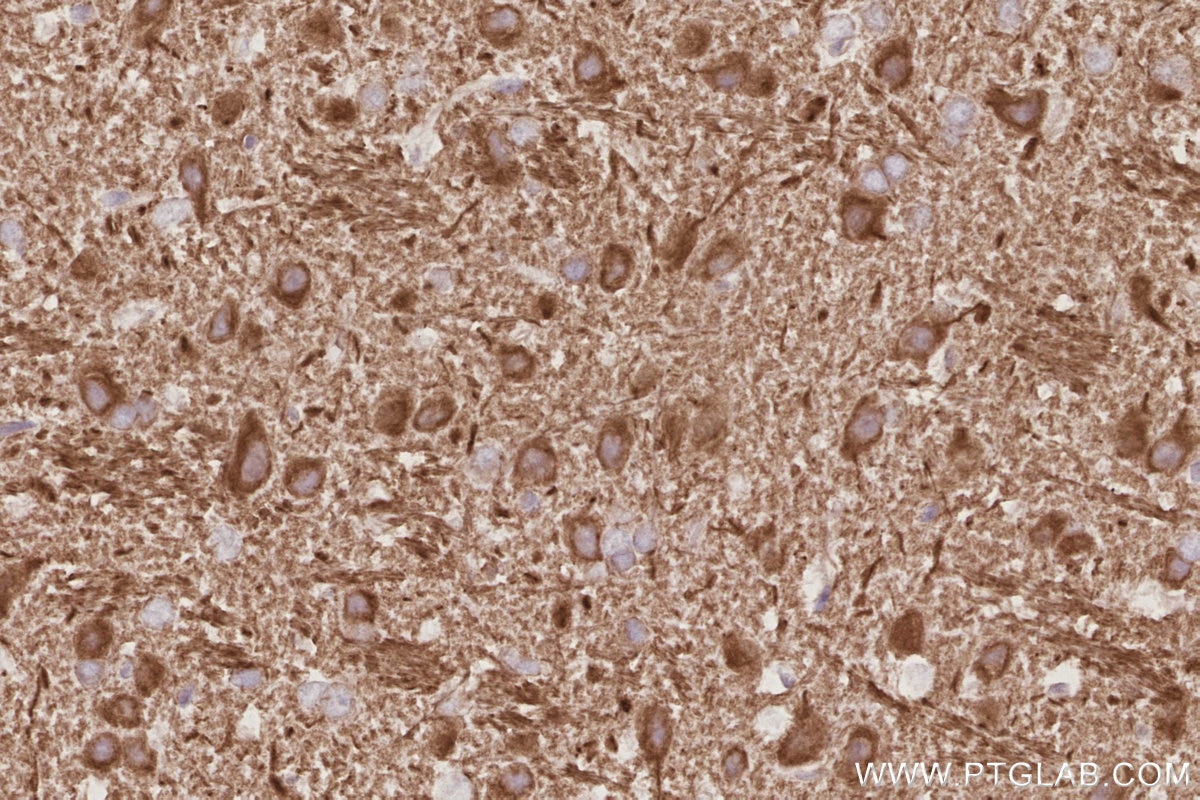Immunohistochemistry (IHC) staining of rat brain tissue using WASF3 Monoclonal antibody (67620-1-Ig)
