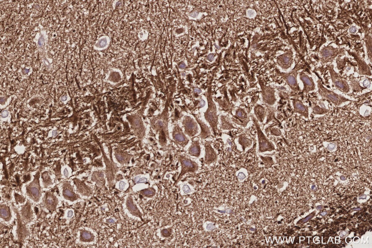 Immunohistochemistry (IHC) staining of rat brain tissue using WASF3 Monoclonal antibody (67620-1-Ig)