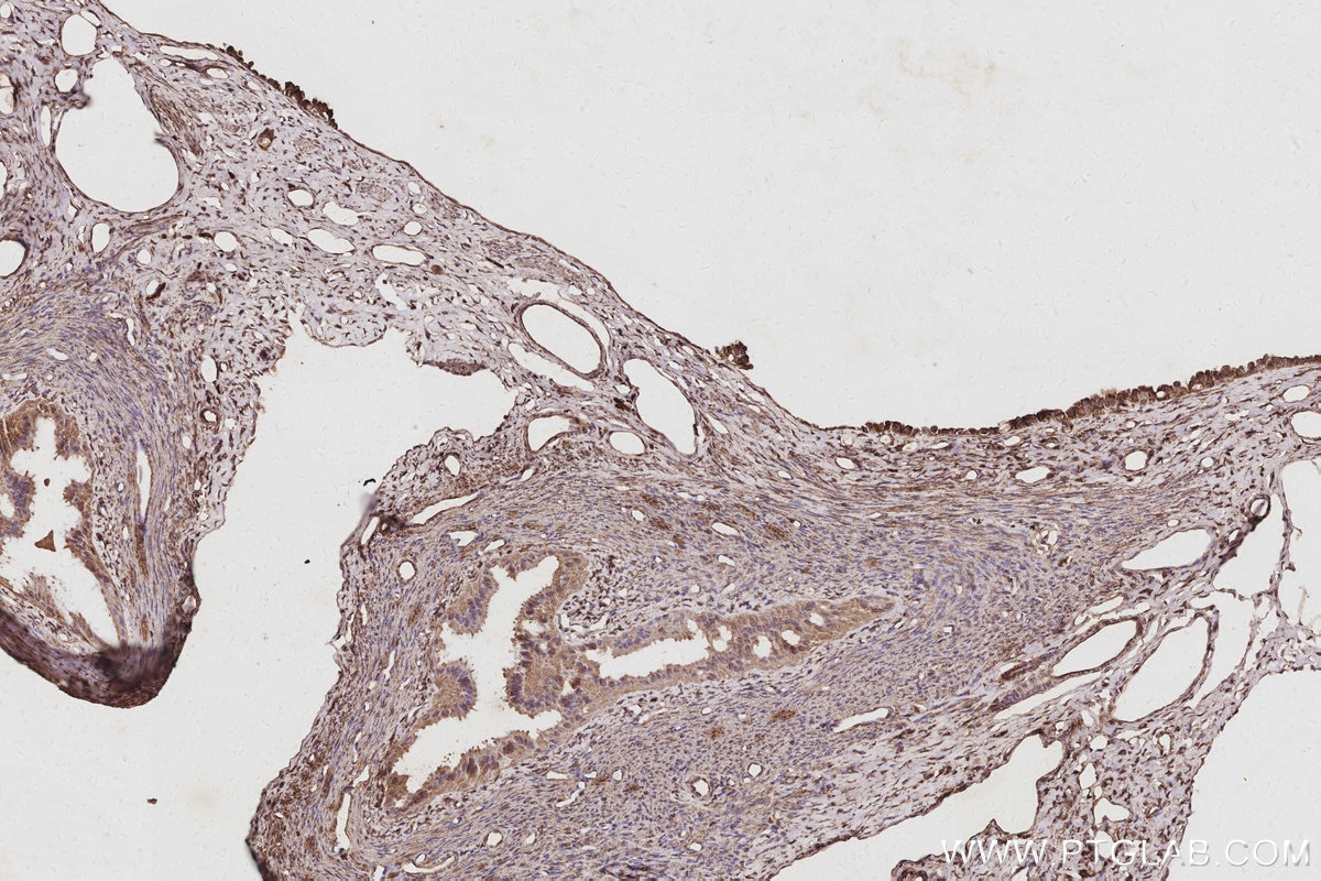 Immunohistochemistry (IHC) staining of rat ovary tissue using WASF3 Monoclonal antibody (67620-1-Ig)
