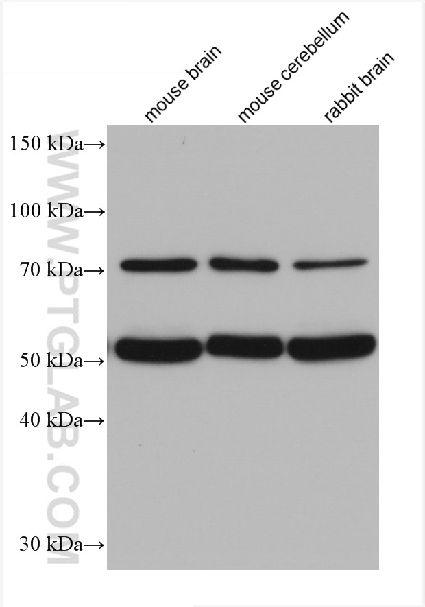 Western Blot (WB) analysis of various lysates using WASF3 Monoclonal antibody (67620-1-Ig)