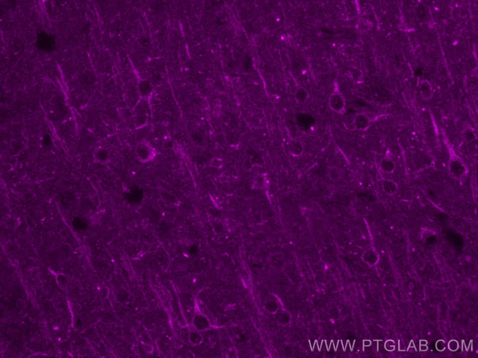 Immunofluorescence (IF) / fluorescent staining of mouse brain tissue using CoraLite® Plus 647-conjugated WASF3 Monoclonal ant (CL647-67620)