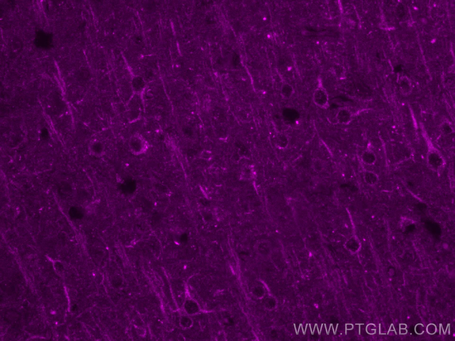 Immunofluorescence (IF) / fluorescent staining of mouse brain tissue using CoraLite® Plus 647-conjugated WASF3 Monoclonal ant (CL647-67620)