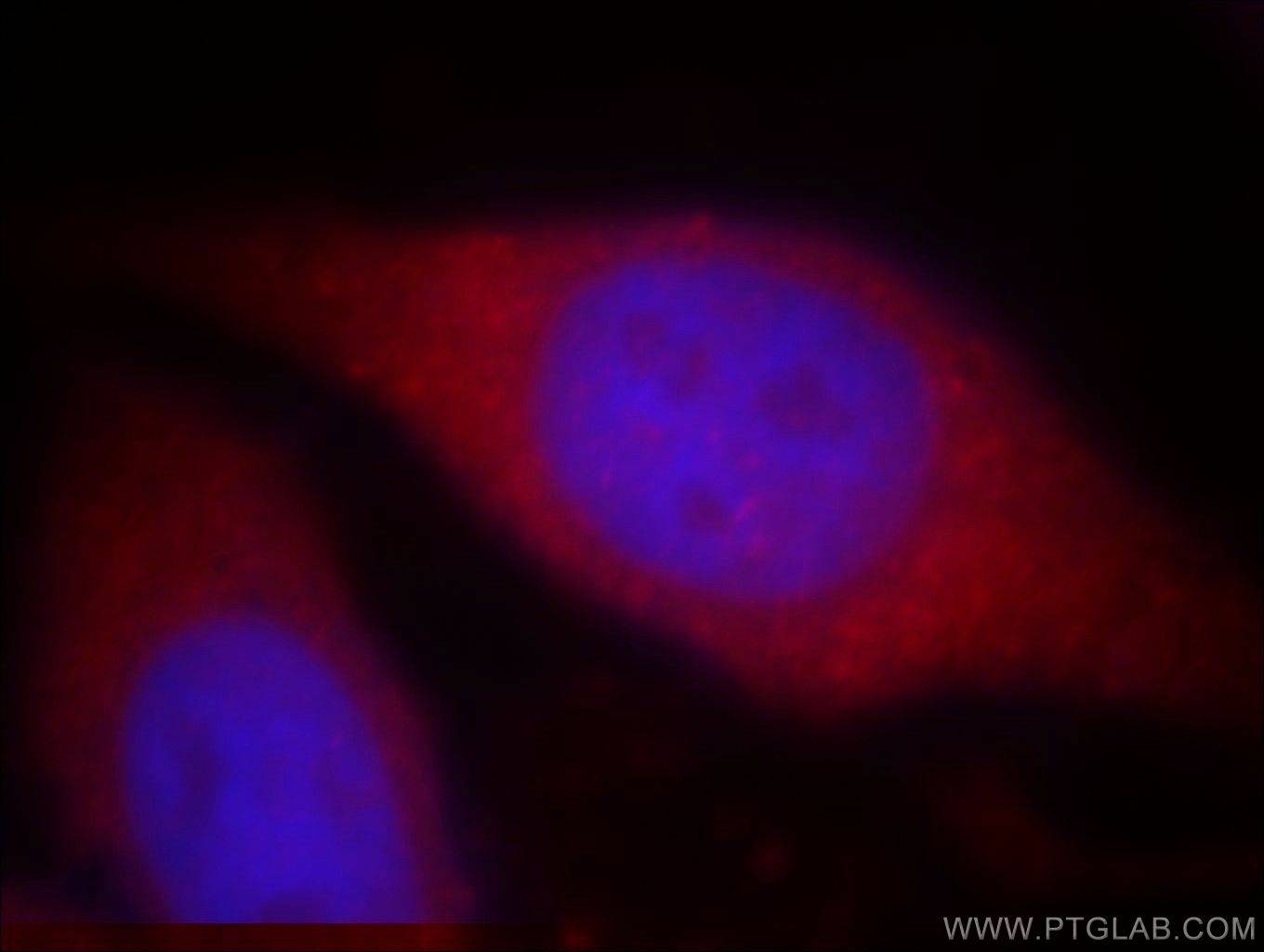 Immunofluorescence (IF) / fluorescent staining of HepG2 cells using WASF4-Specific Polyclonal antibody (19755-1-AP)
