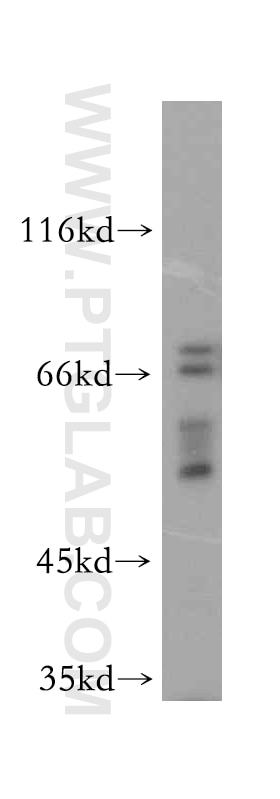 Western Blot (WB) analysis of mouse brain tissue using WASF4-Specific Polyclonal antibody (19755-1-AP)