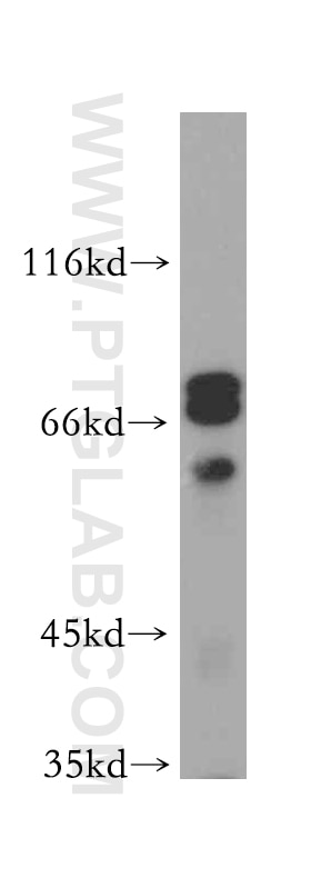 Western Blot (WB) analysis of mouse brain tissue using WASF4-Specific Polyclonal antibody (19755-1-AP)