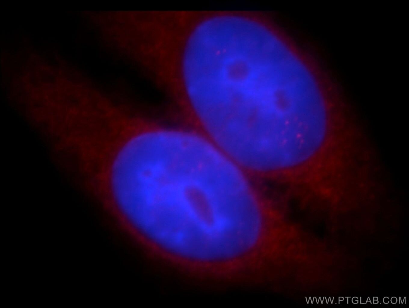 Immunofluorescence (IF) / fluorescent staining of HepG2 cells using WASL Polyclonal antibody (14306-1-AP)