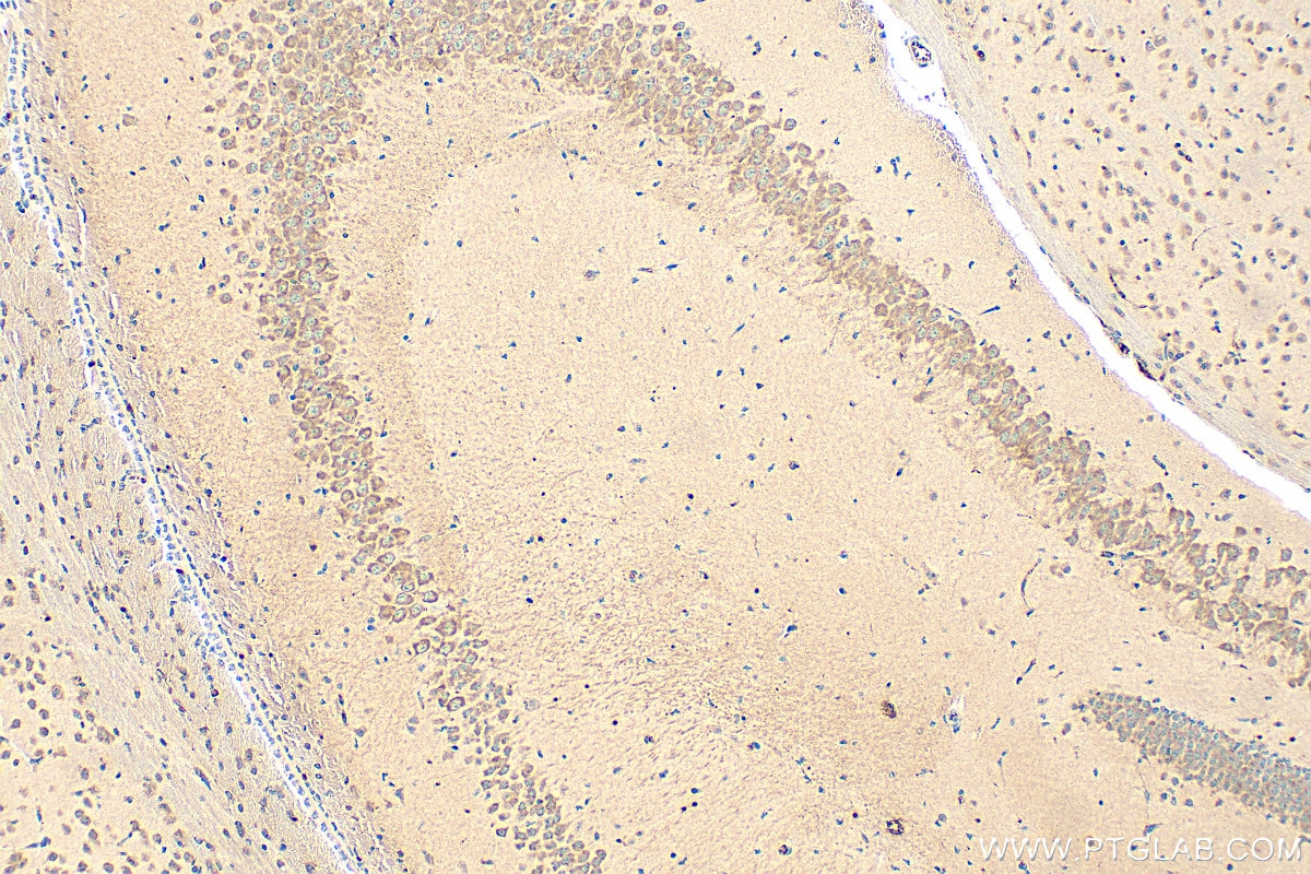 Immunohistochemical analysis of paraffin-embedded mouse brain tissue slide using 14306-1-AP (WASL antibody) at dilution of 1:200 (under 10x lens). Heat mediated antigen retrieval with Tris-EDTA buffer (pH 9.0). Immunohistochemistry (IHC) staining of mouse brain tissue using WASL Polyclonal antibody (14306-1-AP)