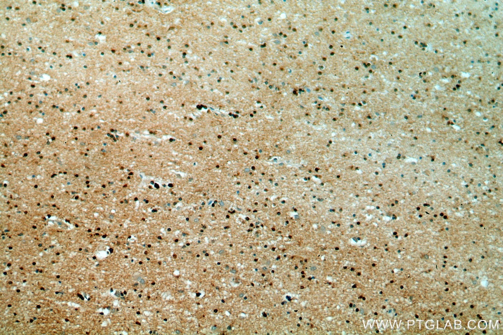 Immunohistochemistry (IHC) staining of human brain tissue using WASL Polyclonal antibody (14306-1-AP)