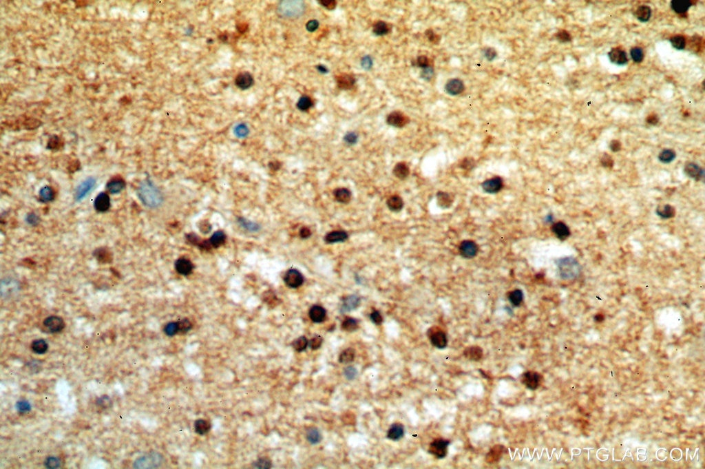 IHC staining of human brain using 14306-1-AP