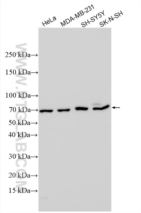 Western Blot (WB) analysis of various lysates using WASL Polyclonal antibody (14306-1-AP)