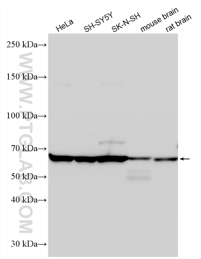 Western Blot (WB) analysis of various lysates using WASL Polyclonal antibody (14306-1-AP)