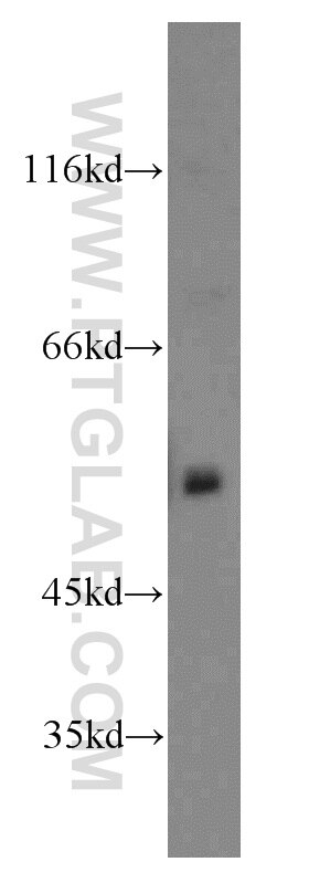 Western Blot (WB) analysis of mouse brain tissue using WASL Polyclonal antibody (14306-1-AP)