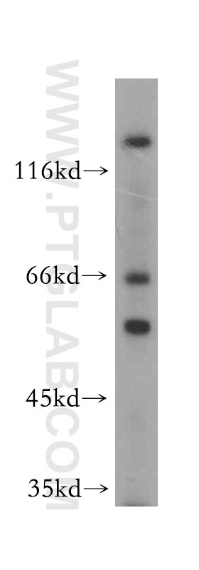 Western Blot (WB) analysis of mouse brain tissue using WASL Polyclonal antibody (14306-1-AP)