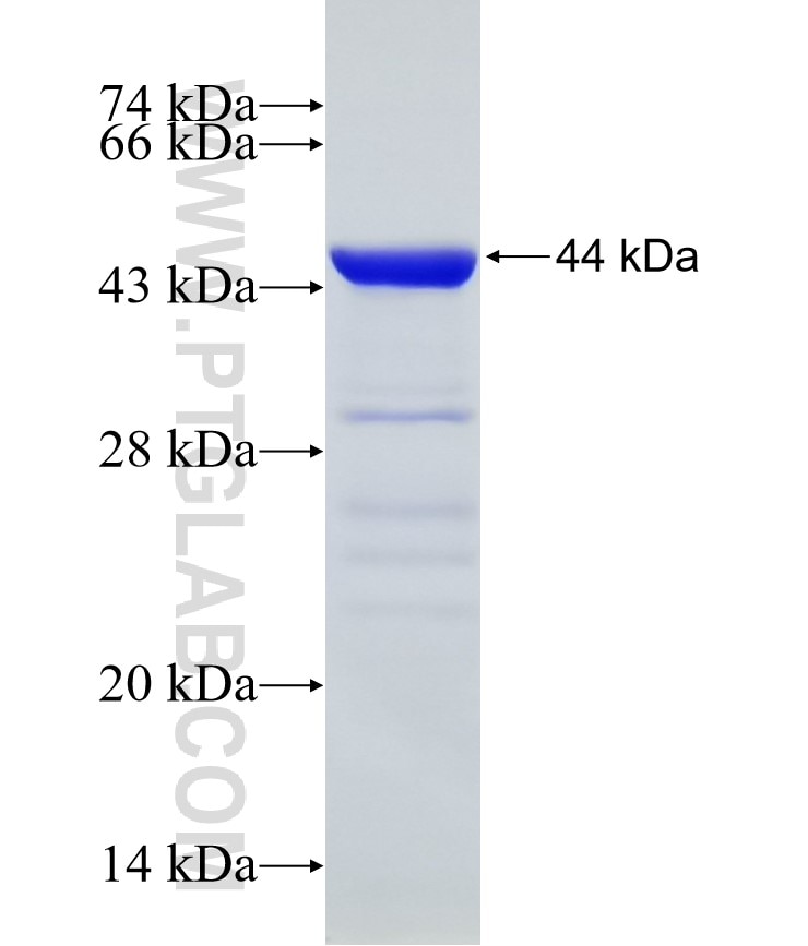 WASL fusion protein Ag5424 SDS-PAGE