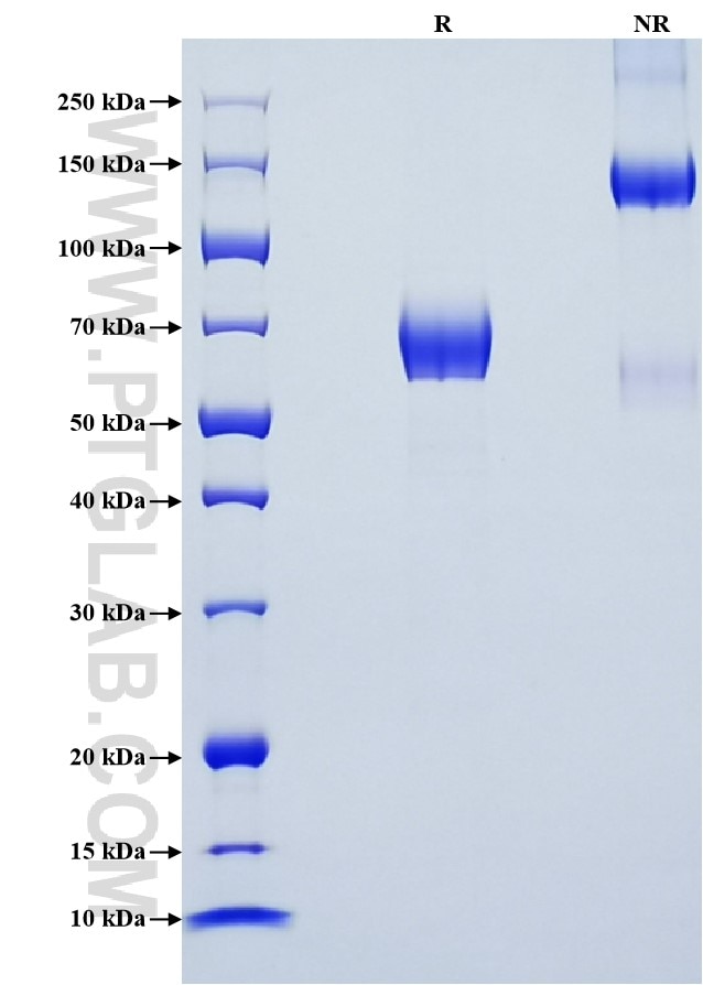 Purity of Recombinant Mouse B7-H3 was determined by SDS-PAGE. The protein was resolved in an SDS-PAGE in reducing (R) and non-reducing (NR) conditions and stained using Coomassie blue. Purity of Recombinant Mouse B7-H3 was determined by SDS-PAGE. The protein was resolved in an SDS-PAGE in reducing (R) and non-reducing (NR) conditions and stained using Coomassie blue.