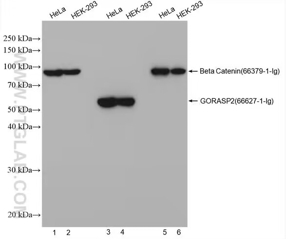 WB of HeLa and HEK-293 Cell lysates (30 μg/lane): Various cell lysates were detected with anti-Beta Catenin 66379-1-Ig, Mouse IgG1, 0.44 μg) labeled with FlexAble HRP Kit (KFA025, 0.88 μL) (Lane 1 and Lane 2); Anti- GORASP2 (66627-1-Ig, Mouse IgG1, 0.18 μg) with FlexAble HRP Kit (KFA025, 0.36 μL) (Lane 3 and Lane 4); anti-Beta Catenin (66379-1-Ig, Mouse IgG1, 0.44 μg) labeled with FlexAble HRP Kit (KFA025, Linker 1.76 μL) with Quencher 0.88 μL, add 0.18 μg GORASP2 antibody as competitor antibody (Lane 5 and Lane 6).
Primary antibody : Linker : Quencher=0.5 μg : 1 μL : 2 μL