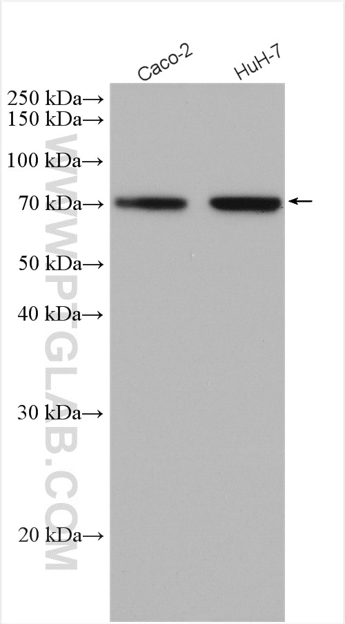 Various cell lysates were subjected to SDS PAGE followed by western blot with 20507-1-AP (DMT1 antibody) at dilution of 1:800 incubated at room temperature for 1.5 hours.
